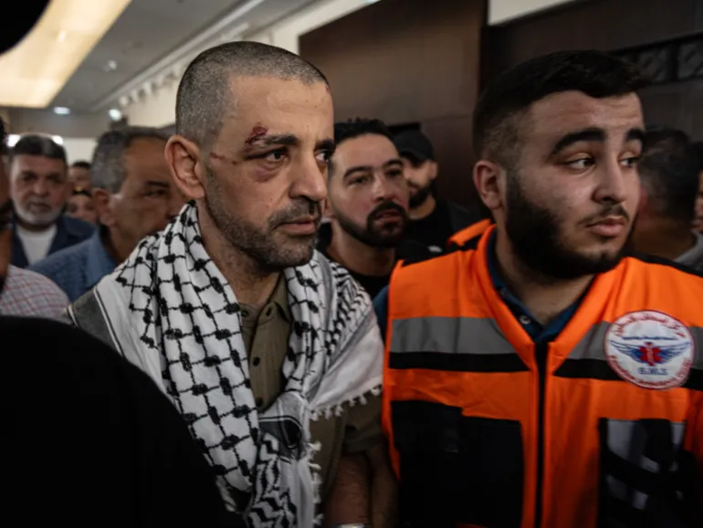 A facial injury is visible on a Palestinian prisoner during the families' reception of the released prisoners from Israeli prisons on October 13, 2025 in Ramallah, West Bank. (Faiz Abu Rmeleh/Getty Images)