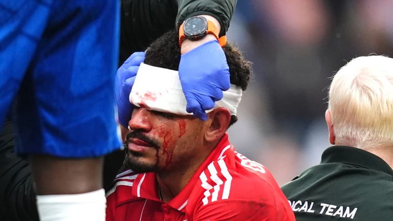 Nottingham Forest's Morgan Gibbs-White receives treatment for a head injury following a collision with Chelsea goalkeeper Robert Sanchez during the 